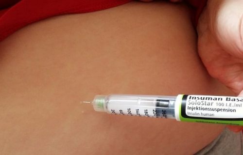 Is it possible to be lean and diabetic?