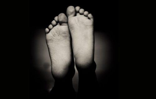 Diabetes can reach your feet